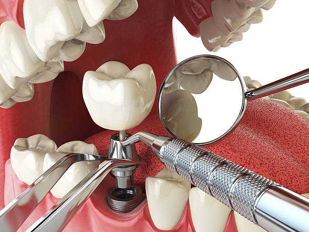 Best Emergency Dental Care for Sports Injuries in Niles, OH